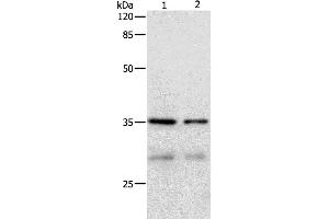Western Blotting (WB) image for anti-Cyclin-Dependent Kinase 4 (CDK4) antibody (ABIN2427935) (CDK4 抗体)