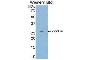 Western Blotting (WB) image for anti-Cysteine-Rich, Angiogenic Inducer, 61 (CYR61) (AA 176-379) antibody (ABIN1858599)