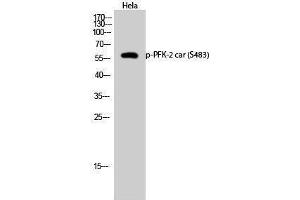 Western Blotting (WB) image for anti-6-phosphofructo-2-Kinase/fructose-2,6-Biphosphatase 2 (PFKFB2) (pSer483) antibody (ABIN3173263) (PFKFB2 抗体  (pSer483))