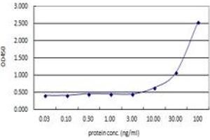 ACTN4 (Human) Matched Antibody Pair