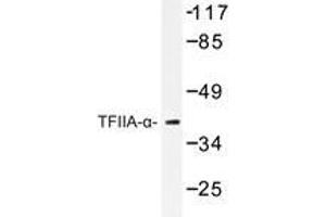Western blot analysis of TFIIA-α antibody in extracts from RAW264. (GTF2A1 抗体)