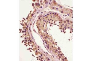 (ABIN6243510 and ABIN6578883) staining BRAF in human testis tissue sections by Immunohistochemistry (IHC-P - paraformaldehyde-fixed, paraffin-embedded sections).