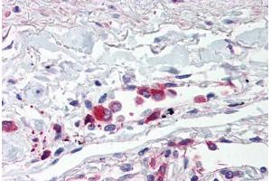 Human Lung, Alveolar Macrophages (formalin-fixed, paraffin-embedded) stained with TLR5 antibody ABIN214528 at 5 ug/ml followed by biotinylated goat anti-rabbit IgG secondary antibody ABIN481713, alkaline phosphatase-streptavidin and chromogen. (TLR5 抗体  (Internal Region))