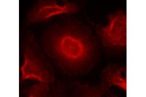 Immunofluorescence staining of methanol-fixed HeLa cells using GRIN2B polyclonal antibody (Cat # PAB12211, Red).
