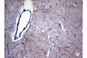 Image no. 4 for anti-Neurofilament, Light Polypeptide (NEFL) (AA 1-360) antibody (ABIN1490762)