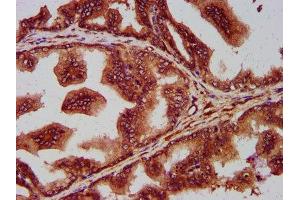 Immunohistochemistry (IHC) image for anti-SEC14-Like 2 (SEC14L2) (AA 233-358) antibody (ABIN7168647)