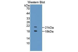 Western blot analysis of the recombinant protein. (TRPV6 抗体  (AA 578-725))