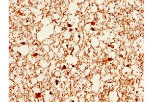 IHC image of ABIN7146715 diluted at 1:400 and staining in paraffin-embedded human brain tissue performed on a Leica BondTM system. (CA2 抗体  (AA 2-260))
