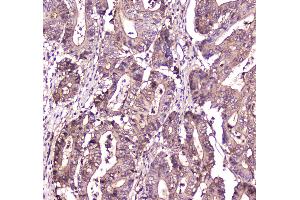 Immunohistochemistry (IHC) image for anti-S100 Calcium Binding Protein A10 (S100A10) (AA 4-94) antibody (ABIN5692833)