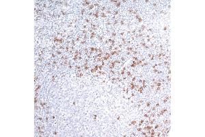 Immunohistochemistry (IHC) image for anti-CD8a Molecule (CD8A) (AA 185-235) antibody (ABIN7449561) (Recombinant CD8 alpha 抗体  (AA 185-235))