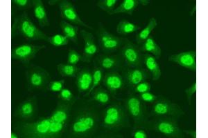 Immunofluorescence analysis of A549 cell using LIG1 antibody. (LIG1 抗体)