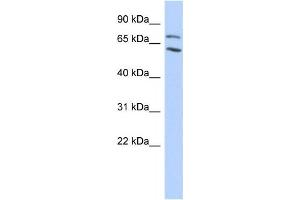 Western Blotting (WB) image for anti-Metastasis Associated 1 Family, Member 2 (MTA2) antibody (ABIN2458168) (MTA2 抗体)