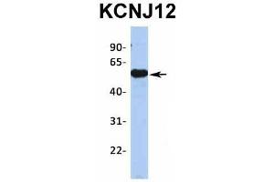 Host:  Rabbit  Target Name:  KCNJ12  Sample Type:  Human Fetal Brain  Antibody Dilution:  1. (Kir2.2 抗体  (Middle Region))