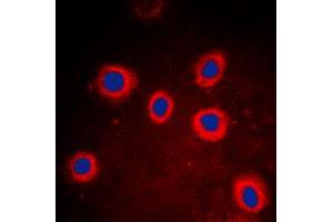 Immunofluorescent analysis of Cytokeratin 8 staining in DLD cells. (KRT8 抗体  (Center))
