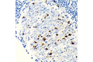 Immunohistochemistry of paraffin-embedded human appendix using Parvalbumin (PVALB) (PVALB) Rabbit mAb (ABIN7269182) at dilution of 1:100 (40x lens). (PVALB 抗体)