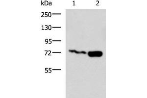 Western blot analysis of Jurkat and Raji cell lysates using PUM3 Polyclonal Antibody at dilution of 1:800 (Pumilio 3 抗体)