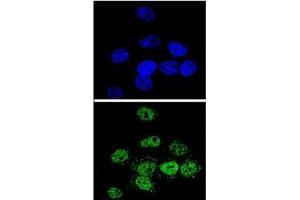 Confocal immunofluorescent analysis of MEF2A Antibody (Center) Cat. (MEF2A 抗体  (Middle Region))