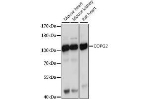 Western blot analysis of extracts of various cell lines, using COPG2 antibody (ABIN7266426) at 1:1000 dilution. (COPG2 抗体  (AA 542-871))