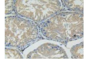 Immunohistochemistry (IHC) image for anti-Glutamic-Oxaloacetic Transaminase 1, Soluble (Aspartate Aminotransferase 1) (GOT1) (AA 1-413) antibody (ABIN7433267)
