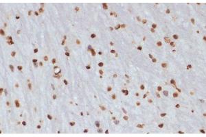 Immunohistochemistry of paraffin-embedded Mouse brain using Phospho-CHEK1(S280) Polyclonal Antibody at dilution of 1:100 (40x lens). (CHEK1 抗体  (pSer280))