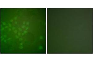 Immunofluorescence analysis of A549 cells, using RAD17 (Ab-645) Antibody. (RAD17 抗体  (AA 621-670))