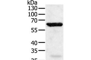 Western Blot analysis of Jurkat cell using TRAF5 Polyclonal Antibody at dilution of 1:450 (TRAF5 抗体)