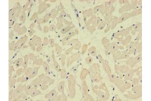 Immunohistochemistry of paraffin-embedded human heart tissue using ABIN7161056 at dilution of 1:100 (NPPB 抗体  (AA 27-102))