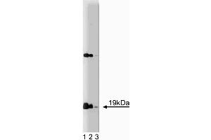 Western blot analysis of alpha-Synuclein on rat brain lysate. (SNCA 抗体  (AA 15-123))
