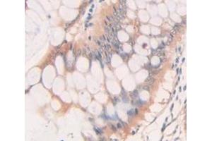 IHC-P analysis of Human Tissue, with DAB staining. (BMP2 抗体  (AA 283-396))