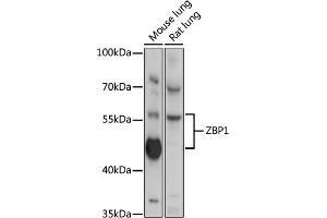 Western blot analysis of extracts of various cell line, using ZBP1 antibody (ABIN6128935, ABIN6150365, ABIN6150367 and ABIN6218066) at 1:3000 dilution. (ZBP1 抗体  (AA 1-200))