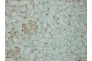Immunohistochemistry (IHC) image for anti-Complement Component C4d (C4d) antibody (ABIN870587) (Complement C4d 抗体)