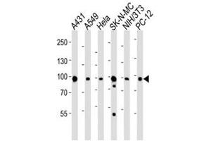 Western blot analysis of lysate from A431, A549, HeLa, SK-N-MC, mouse NIH3T3, rat PC-12 cell line using HSP90 antibody at 1:1000.