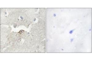 Immunohistochemistry analysis of paraffin-embedded human brain tissue, using LMTK2 Antibody. (LMTK2 抗体  (AA 651-700))