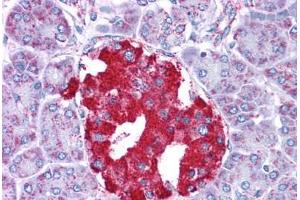 Human Pancreas: Formalin-Fixed, Paraffin-Embedded (FFPE) (GLUD1 抗体  (AA 182-231))