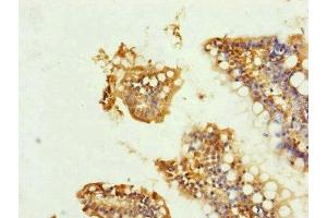 Immunohistochemistry of paraffin-embedded human small intestine tissue using ABIN7149102 at dilution of 1:100 (UQCRC1 抗体  (AA 156-480))