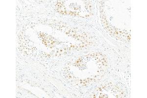 Immunohistochemistry (IHC) image for anti-Bromodomain Containing 7 (BRD7) (AA 601-651) antibody (ABIN7453996)