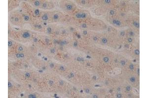 Immunohistochemistry (IHC) image for anti-Cell Death-Inducing DFFA-Like Effector C (CIDEC) (AA 1-251) antibody (ABIN7440137)