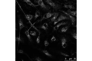 Immunofluorescence (IF) image for anti-RAB14, Member RAS Oncogene Family (RAB14) (C-Term) antibody (ABIN1439997)