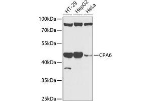 Western blot analysis of extracts of various cell lines, using CP antibody (ABIN6129673, ABIN6138930, ABIN6138932 and ABIN6217722) at 1:1000 dilution. (CPA6 抗体  (AA 130-437))