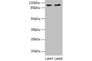 Western blot All lanes: CCDC57 antibody at 1. (CCDC57 抗体  (AA 1-300))