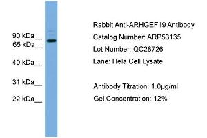 WB Suggested Anti-ARHGEF19  Antibody Titration: 0. (ARHGEF19 抗体  (Middle Region))