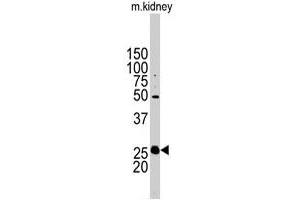 Western blot analysis of STC2 polyclonal antibody  in mouse kidney tissue lysates (35 ug/lane).