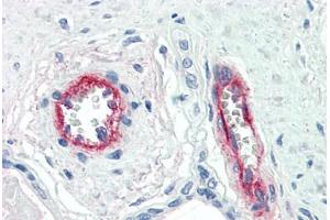 Human Placenta, Vessels (formalin-fixed, paraffin-embedded) stained with F8 antibody ABIN396921 at 10 ug/ml followed by biotinylated anti-mouse IgG secondary antibody ABIN481714, alkaline phosphatase-streptavidin and chromogen. (Factor VIII 抗体)