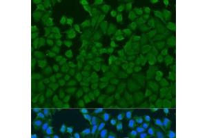 Immunofluorescence analysis of U2OS cells using IL27RA Polyclonal Antibody at dilution of 1:100. (IL27 Receptor alpha 抗体)