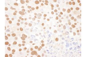 Immunohistochemistry (IHC) image for anti-Interleukin Enhancer Binding Factor 2, 45kDa (ILF2) (AA 340-390) antibody (ABIN7453441)