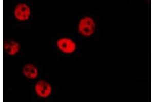 ABIN6279703 staining Hela by IF/ICC. (SFRS14 抗体  (Internal Region))