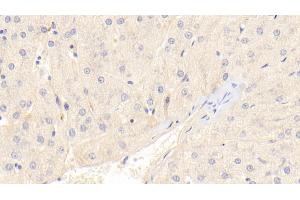 Immunohistochemistry (IHC) image for anti-Advanced Glycosylation End Product-Specific Receptor (AGER) (AA 91-274) antibody (ABIN7432304)