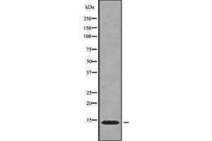 Western blot analysis of CCL16 using HT29 whole cell lysates (CCL16 抗体  (N-Term))