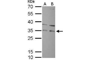 WB Image RPA32 antibody detects RPA2 protein by Western blot analysis. (RPA2 抗体)