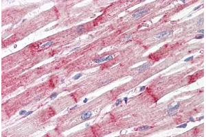 Anti-Nestin antibody IHC staining of human heart. (Nestin 抗体)